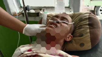 Diduga Depresi, Ketua RT Gorok Leher Sendiri Hingga Nyaris Putus